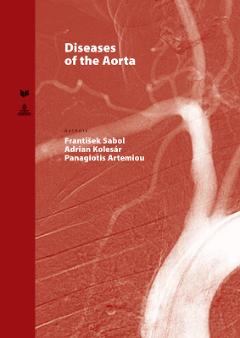Kniha: Diseases of the Aorta - Panagiotis Artemiou