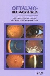 Kniha: Oftalmo-reumatológia - Prof. MUDr. Jozef Rovenský, DrSc., FRCP