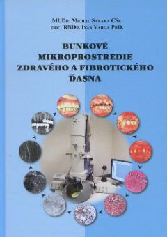 Kniha: Bunkové mikroprostredie zdravého a fibrotického ďasna - Ivan Varga