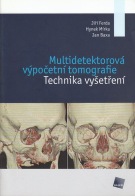 Kniha: Multidetektorová výpočetní tomografie - Jiří Ferda; Hynek Mírka; Jan Baxa
