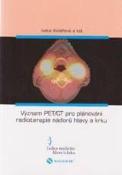 Kniha: Význam PET/CT pro plánování radioterapie nádorů hlavy a krku - Iveta Kolářová