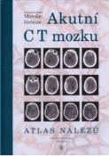 Kniha: Akutní CT mozku - Atlas nálezů - Miroslav Heřman