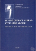 Kniha: Revizní operace náhrad kyčelního kloubu - Oldřich Čech; Valér Džupa