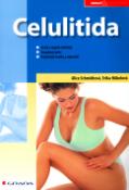 Kniha: Celulitida - Vznik a stupně celulitidy . Komplexní péče . Nejčastěší otázky a odpovědi - Alice Schmidtová, Erika Hübelová