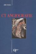 Kniha: CT Angiografie - Jiří Ferda