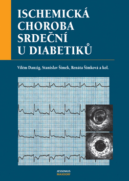 Kniha: Ischemická choroba srdeční - Vilém Danzig, Stanislav Šimek