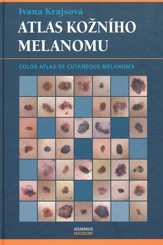 Kniha: Atlas kožního melanomu - Ivana Krajsová