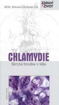 Kniha: Chlamydie Skrytá hrozba v těle - Bohumil Ždichynec